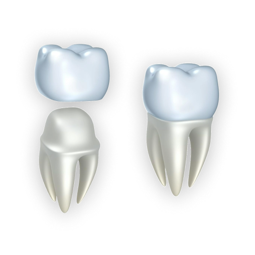 Dental Crown